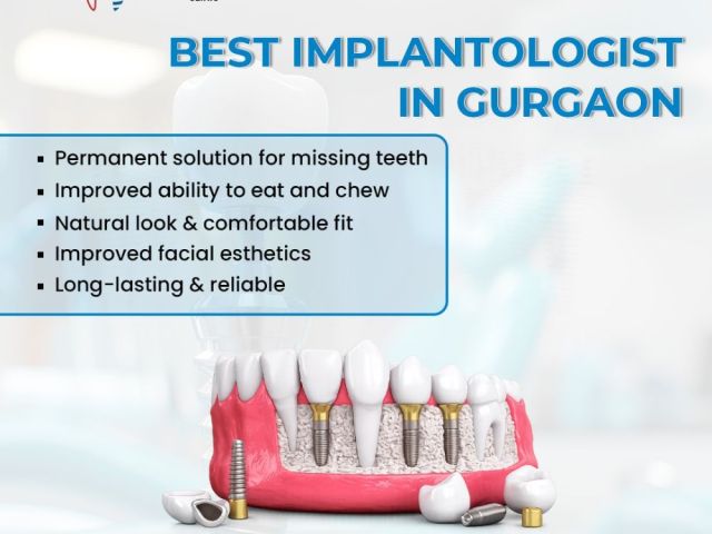 implantologist-in-gurugram-for-modern-tooth-replacement