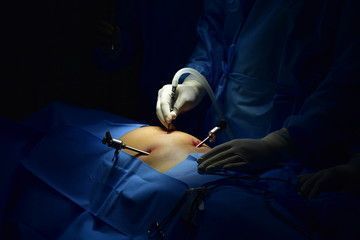 dr-purnendu-roy-leading-laparoscopic-surgeon-in-kolkata-big-0