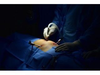 dr-purnendu-roy-leading-laparoscopic-surgeon-in-kolkata-small-0