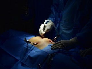dr-purnendu-roy-leading-laparoscopic-surgeon-in-kolkata