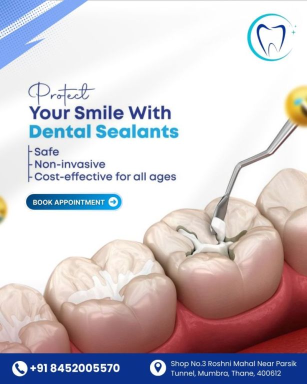 cavities-start-where-your-brush-cant-reach-big-0