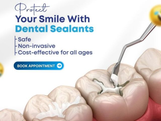 cavities-start-where-your-brush-cant-reach