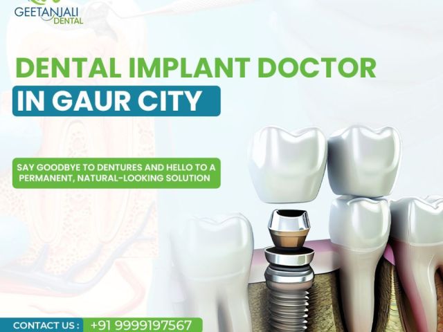 dental-implant-doctor-in-gaur-city-for-long-lasting-solutions