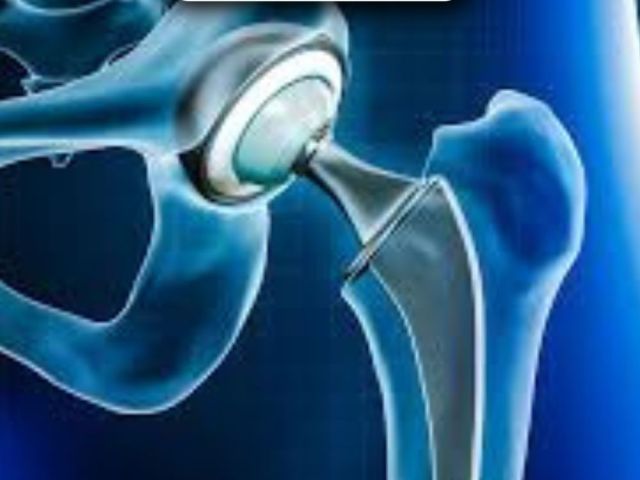 consult-a-3d-robotic-knee-hip-replacement-surgeon-in-ahmedabad