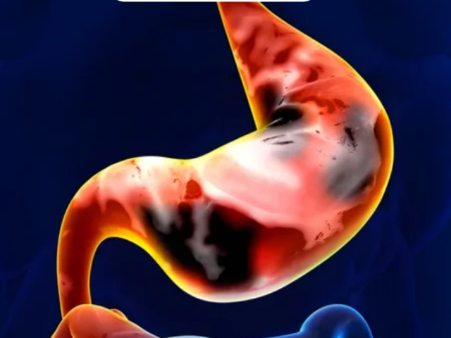 advanced-treatment-for-stomach-cancer-surgery-in-ahmedabad
