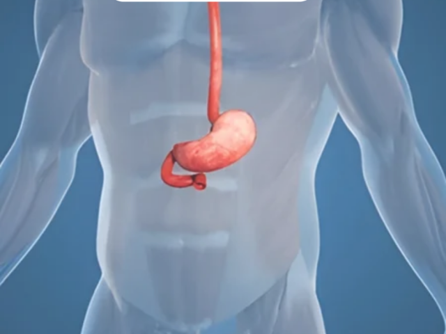 gallbladder-cancer-surgery-in-ahmedabad-by-dr-dhaval-patel