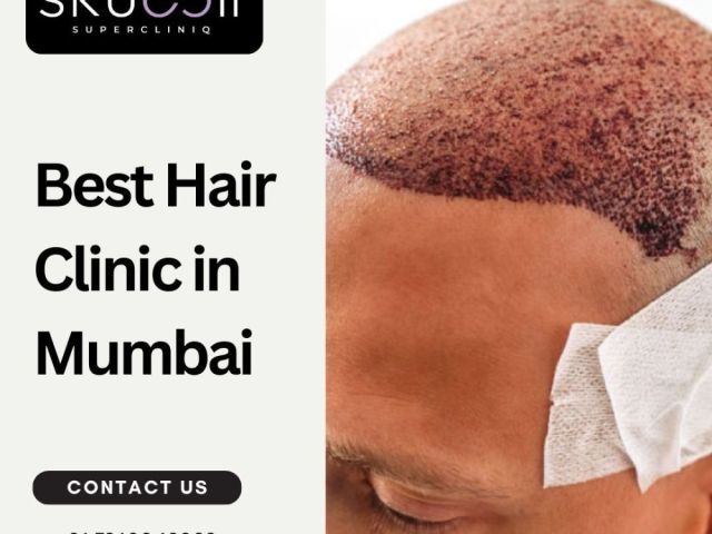 best-hair-clinic-in-mumbai-for-trusted-hair-specialists