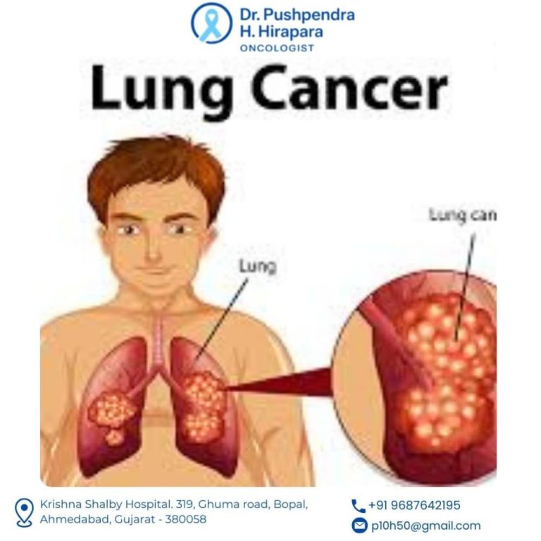 personalized-lung-cancer-treatment-in-ahmedabad-big-0