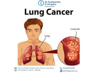 personalized-lung-cancer-treatment-in-ahmedabad-small-0