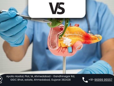 dr-vishal-soni-best-pancreatic-surgeon-in-ahmedabad