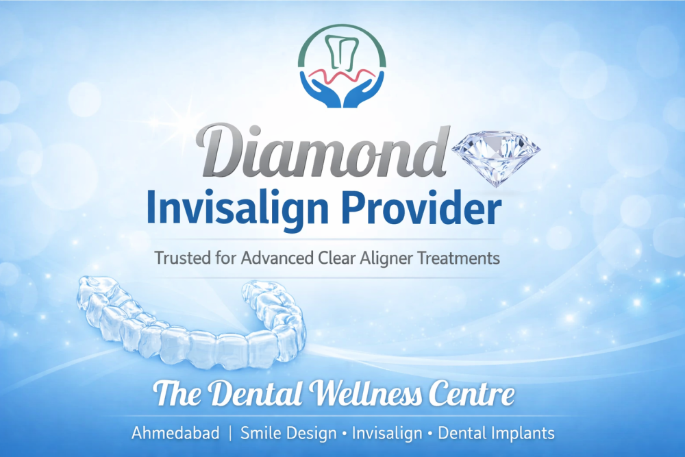 diamond-invisalign-provider-in-ahmedabad-big-0