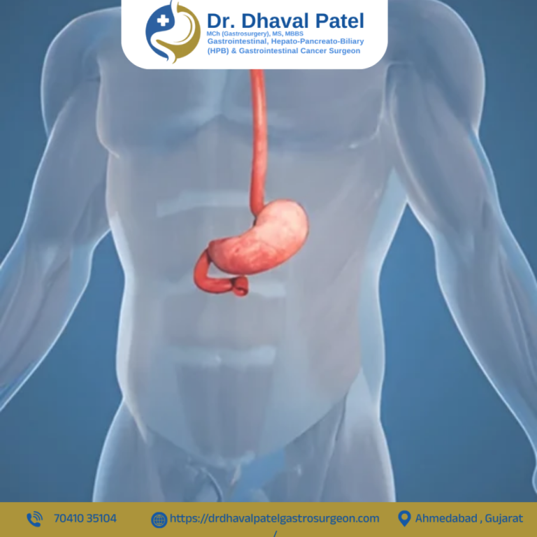 gallbladder-cancer-surgery-in-ahmedabad-drdhaval-patel-big-0