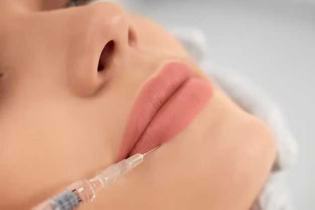 how-long-does-lip-filler-last-big-0