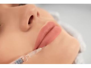 how-long-does-lip-filler-last-small-0