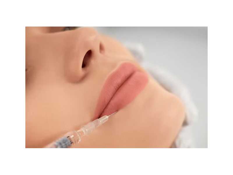how-long-does-lip-filler-last-small-0