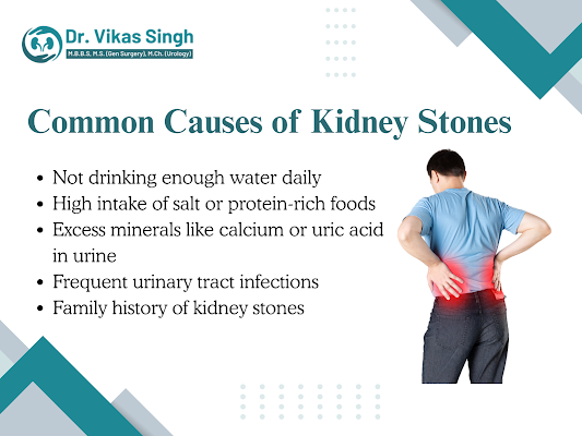 kidney-stone-laser-surgery-in-indore-modern-treatment-big-0