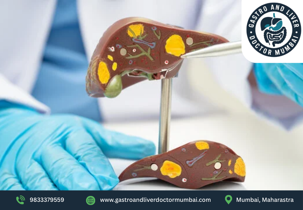 liver-transplant-doctor-for-liver-surgery-dr-chetan-kalal-big-0