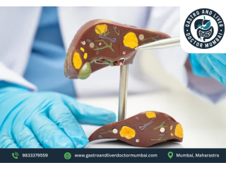 liver-transplant-doctor-for-liver-surgery-dr-chetan-kalal-small-0