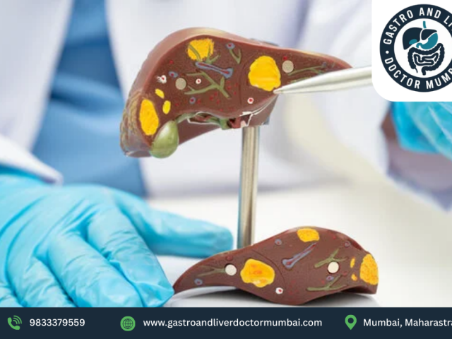 liver-transplant-doctor-for-liver-surgery-dr-chetan-kalal