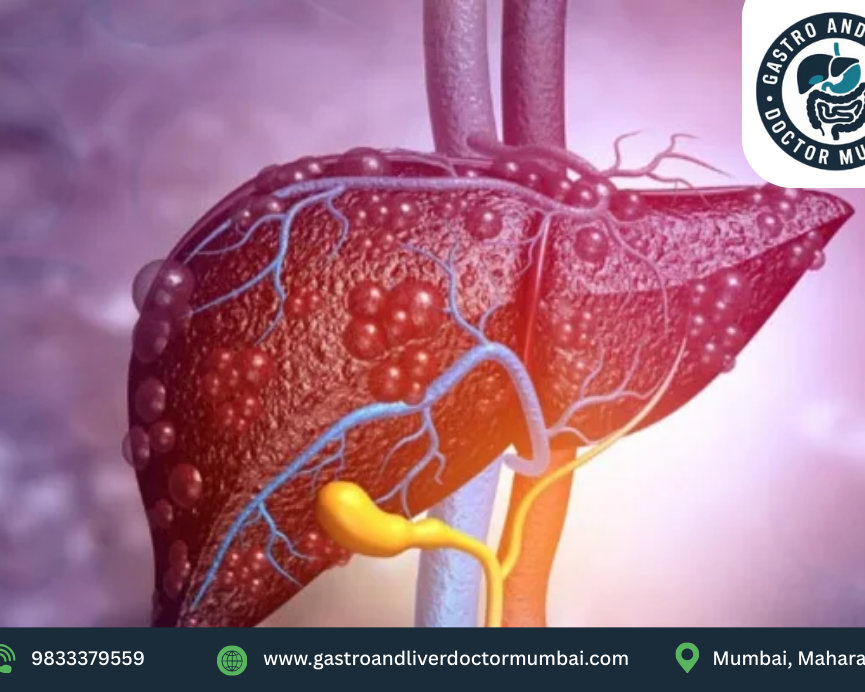liver-biopsy-procedure-in-mumbai-by-dr-chetan-kalal