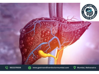 liver-biopsy-procedure-in-mumbai-by-dr-chetan-kalal-small-0