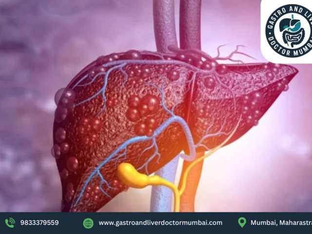 liver-biopsy-procedure-in-mumbai-by-dr-chetan-kalal