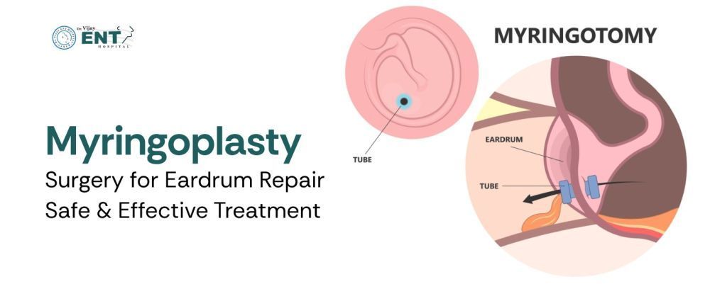 myringoplasty-surgery-for-eardrum-repair-big-0