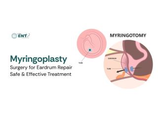 myringoplasty-surgery-for-eardrum-repair-small-0