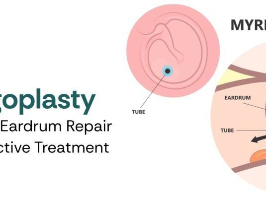 myringoplasty-surgery-for-eardrum-repair