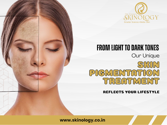 pigmentation-reduction-treatment-in-indore-by-experts