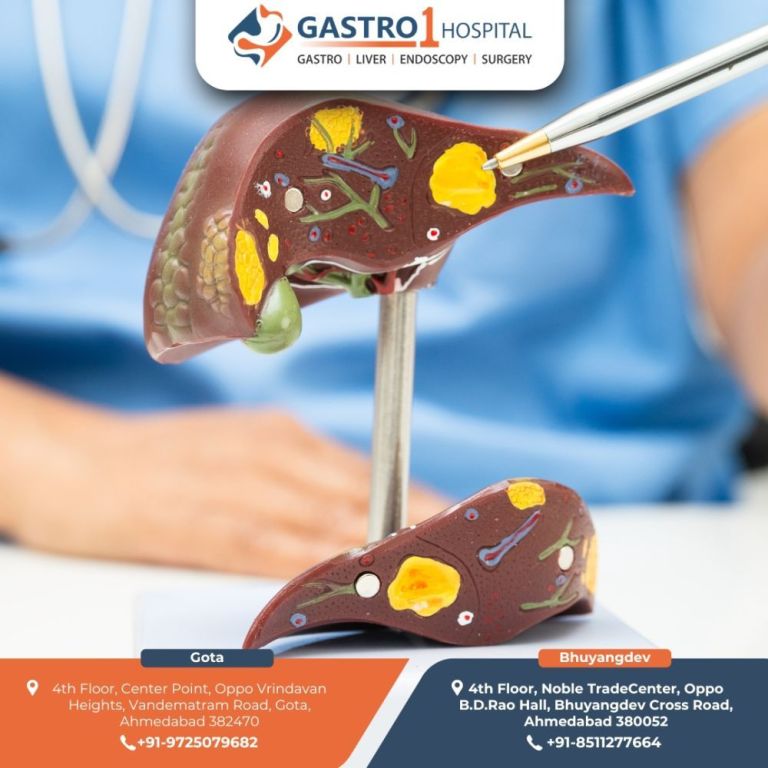 best-gastroenterology-hospital-in-ahmedabad-big-0