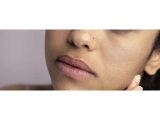 dull-skin-treatment-small-0