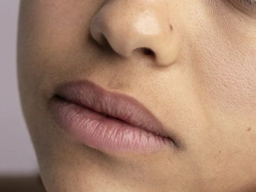 dull-skin-treatment