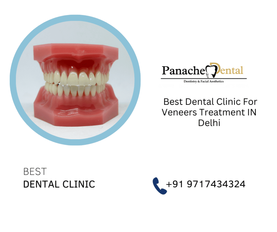 dental-clinic-for-veneers-treatment-in-delhi-panache-dental-big-0