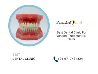 dental-clinic-for-veneers-treatment-in-delhi-panache-dental-small-0