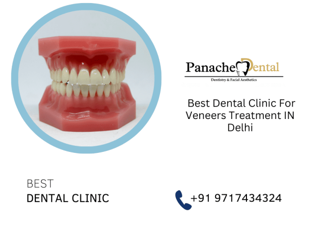 dental-clinic-for-veneers-treatment-in-delhi-panache-dental