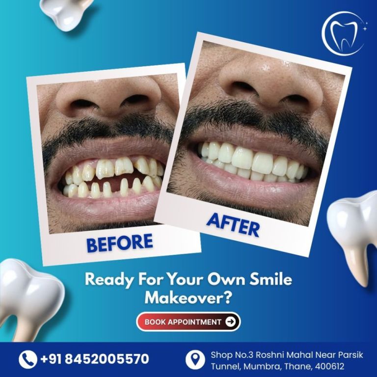 at-our-clinic-we-offer-advanced-cosmetic-dentistry-big-0