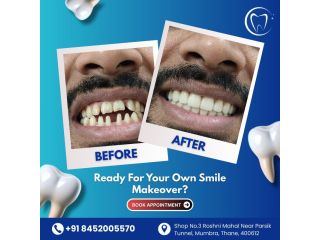 at-our-clinic-we-offer-advanced-cosmetic-dentistry-small-0