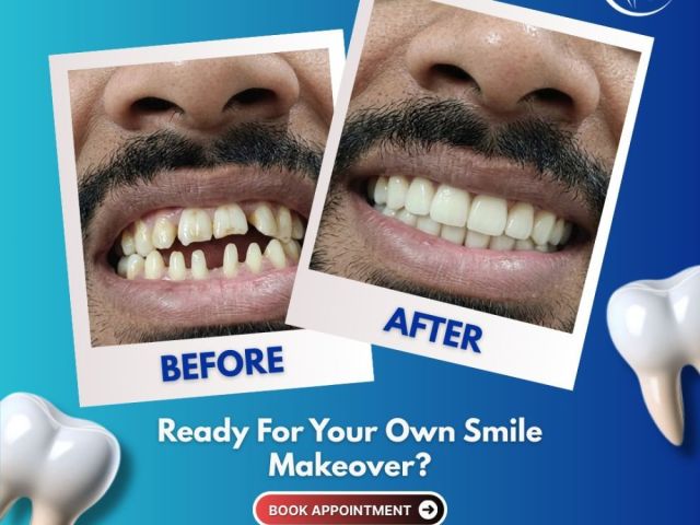 at-our-clinic-we-offer-advanced-cosmetic-dentistry