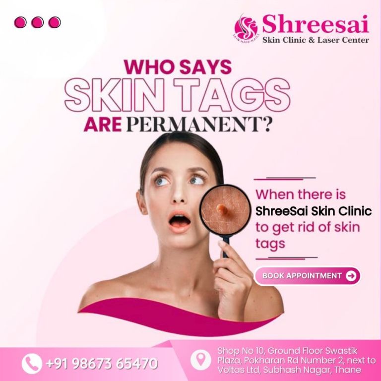 think-skin-tags-are-permanent-think-again-big-0