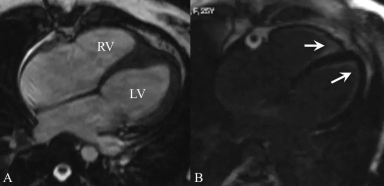 same-day-reports-cardiac-mri-scan-in-mumbai-by-picture-this-big-0