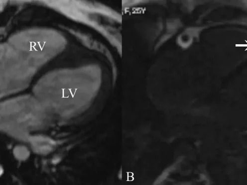 same-day-reports-cardiac-mri-scan-in-mumbai-by-picture-this