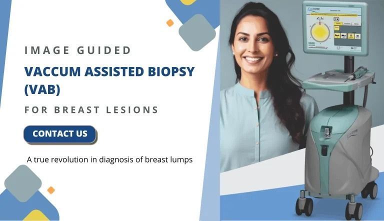 advanced-vacuum-assisted-breast-biopsy-at-picture-this-big-0