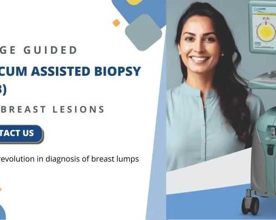advanced-vacuum-assisted-breast-biopsy-at-picture-this