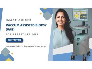 advanced-vacuum-assisted-breast-biopsy-at-picture-this-small-0