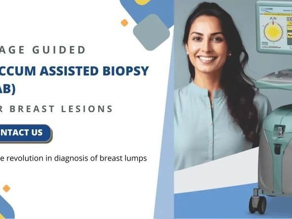 advanced-vacuum-assisted-breast-biopsy-at-picture-this