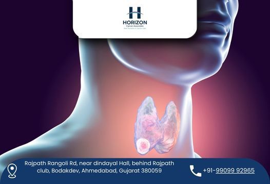 dr-bhavin-vadodariya-head-neck-cancer-surgeon-in-ahmedabad-big-0
