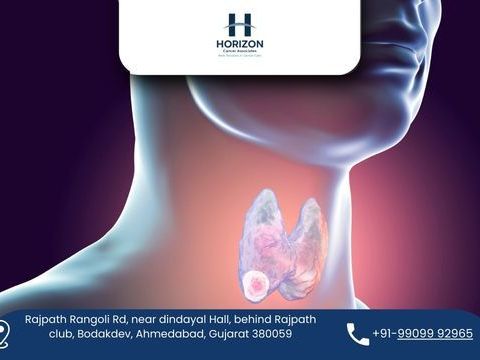 dr-bhavin-vadodariya-head-neck-cancer-surgeon-in-ahmedabad