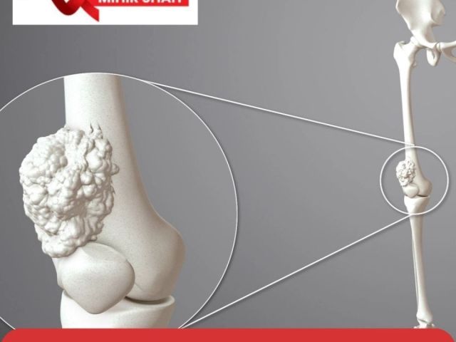 best-soft-tissue-sarcoma-cancer-treatment-dr-mihir-shah