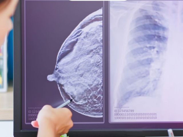 best-medical-oncologist-in-ahmedabad